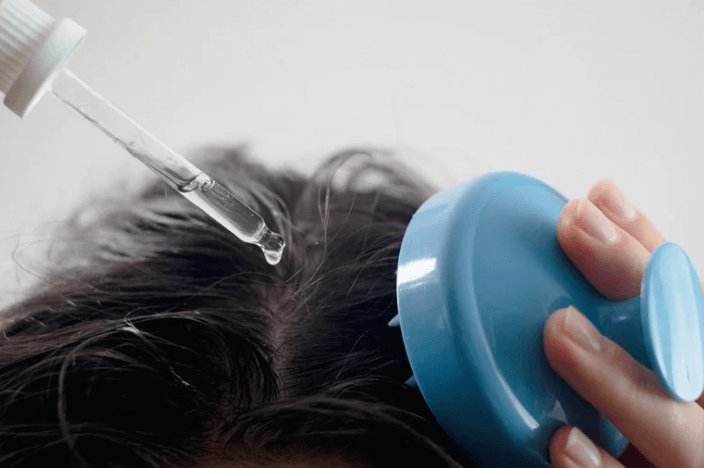 How do I fix my dry scalp fast?