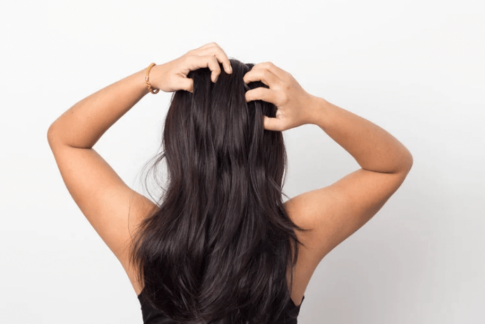 16 Dry Scalp Remedies That Actually Work (No More Flakes & Itchiness!)